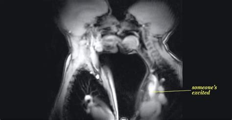 What Does Sex Look Like From The Inside Footage From An Mri Scanner