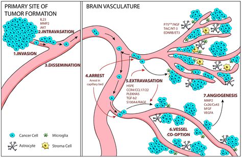 Melanoma Skin Cancer Metastasis