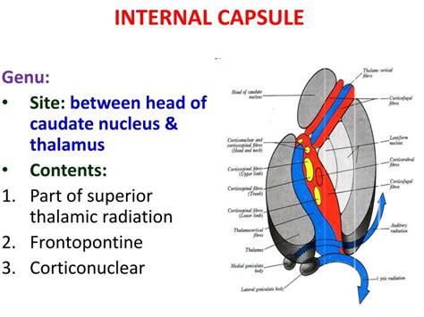 Internal Capsule Stroke