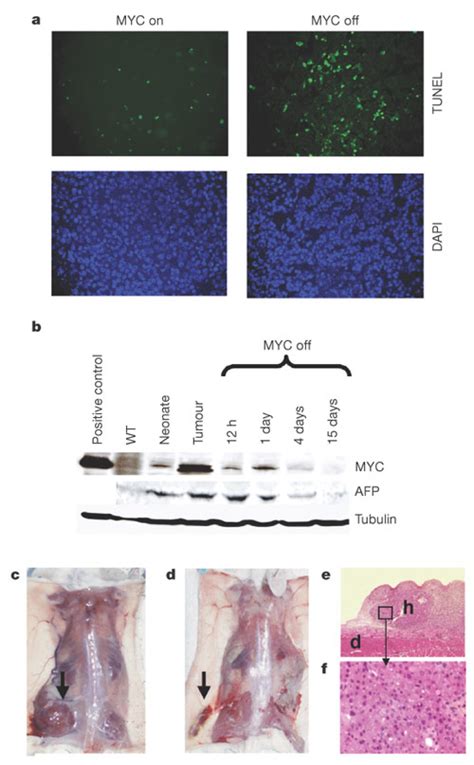 MYC Inactivation In Liver Tumours Results In Rapid Tumour Regression