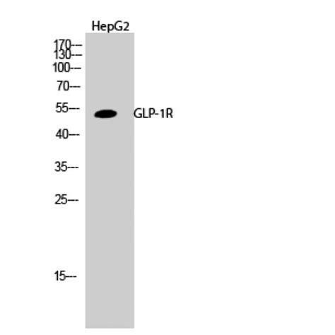 Anti-GLP1R / GLP-1 Receptor Antibody | Rabbit anti-Human | LSBio