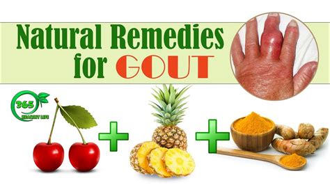 🍀gout Treatment Say Goodbye To Gout Forever With This Powerful Natural