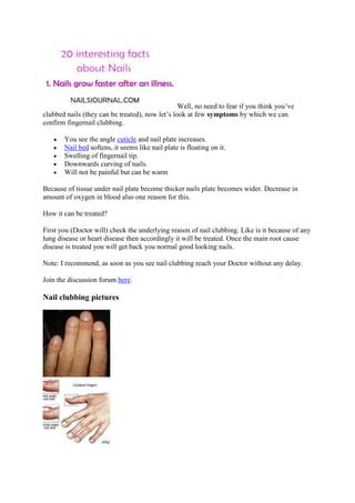 Fingernail clubbing causes | PDF