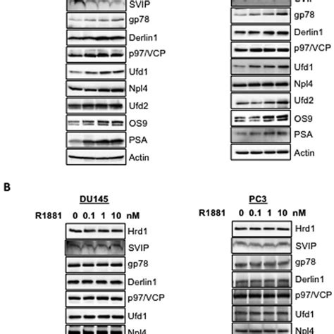 Regulation Of Erad By Androgen Is Present In Androgen Sensitive Cell