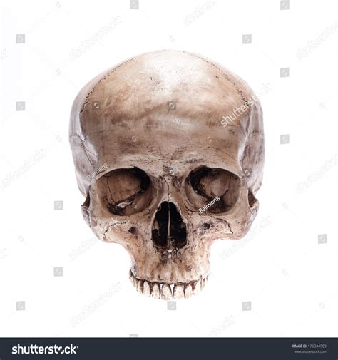 Real Human Skull No Jaw