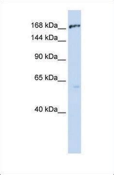 abcc antibody western sab