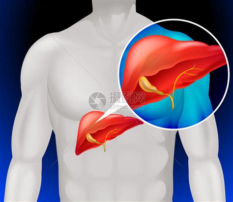 肝癌图详细说明插画图片下载 正版图片402281348 摄图网