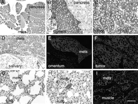 Histopathology of metastatic lesions in nude mice 5 μm sections of the Download Scientific