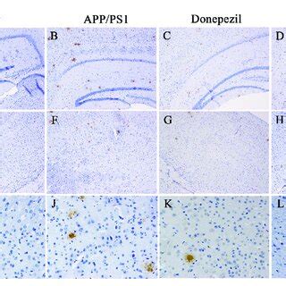 Effect Of Aof On App Ps Mice In Ihc Test A D Dab Stained A Plaques