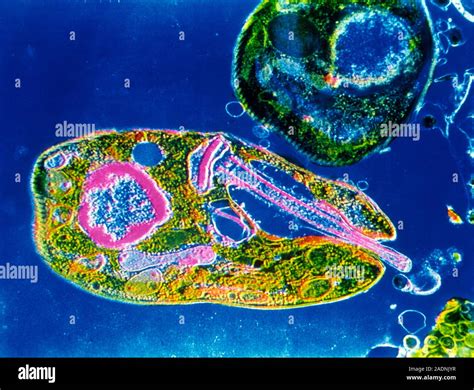 False Colour Transmission Electron Micrograph TEM Of Leishmania Sp