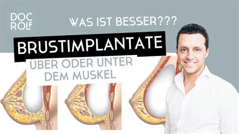 Brustimplantate Ber Oder Unter Dem Muskel Dr Rolf Bartsch Youtube