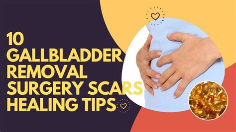 10 Gallbladder Removal Surgery Scars Healing Tips Youtube