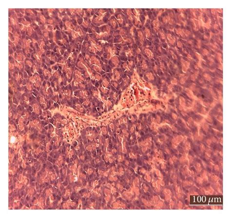 Histology Of Pancreas Of Control And Gdm Group A H And E Staining On Download Scientific