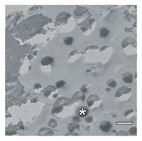 A Von Kossa Staining And Counterstaining With Methylene Blue Most