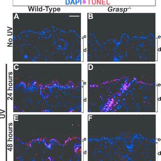 Grasp Is Induced In The Epidermal And Dermal Layers Of Skin Following A