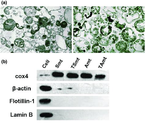 A Electron Microscopy Image Of Mitochondria Morphology The