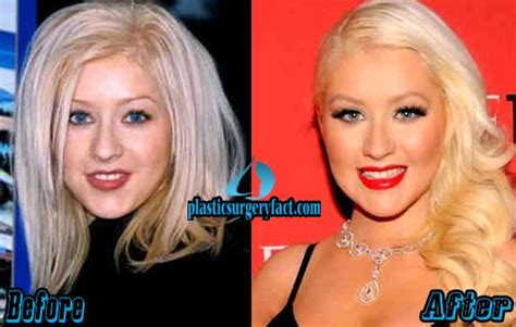 Christina Aguilera Plastic Surgery Before and After Photos - Plastic ...