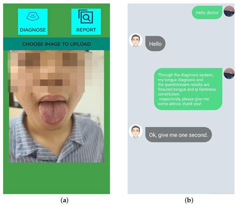 Diagnostics Free Full Text An Intelligent Tongue Diagnosis System