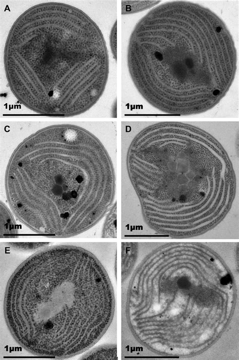 TEM Of Synechocystis Wild Type And Mutant Cells Electron Micrographs