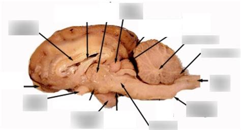 Sheep Brain Midsagittal Diagram Quizlet