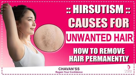 Hirsutism Causes Of Unwanted Hair Growth How To Remove Hair Permanently Chavanss Unik