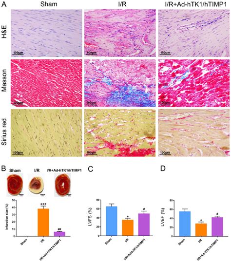 Ad Htk Htimp Significantly Ameliorates Myocardial Injury And Improves