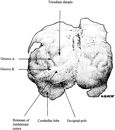 Morphology and histology of chimpanzee primary visual striate cortex indicate that brain ...