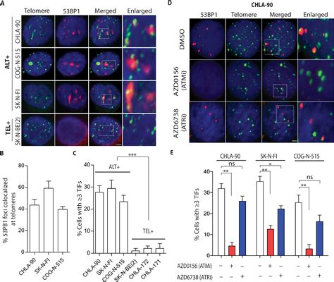 ALT Neuroblastoma Chemoresistance Due To Telomere Dysfunctioninduced