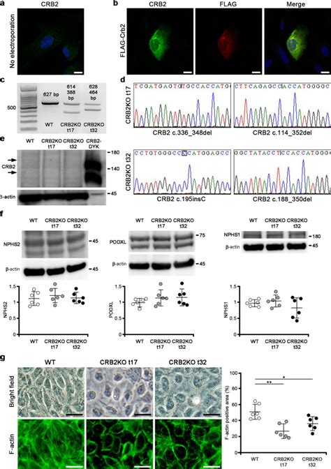 Podocyte Specific Crb Knockout Mice Develop Focal Segmental