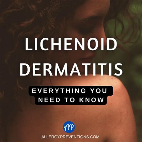 Lichenoid Dermatitis: Everything You Need To Know