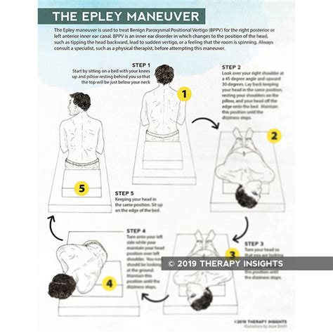 Get Epley Maneuver Steps With Pictures Pics