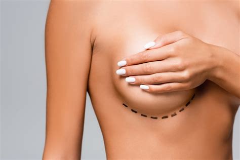 Rediscover Your Aesthetic Self With Breast Implant Fidel Clinic