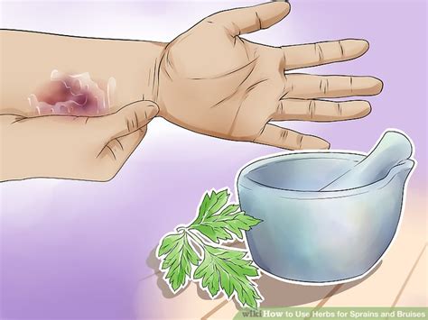 Ways To Use Herbs For Sprains And Bruises Wikihow