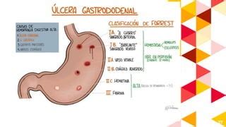 Hemorragia Digestiva Alta Y Baja Pptx