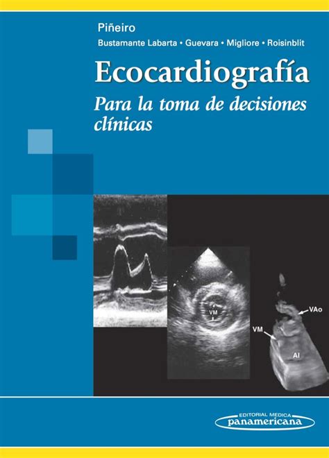 Ecocardiograf A Para La Toma De Decisiones Cl Nicas Ebook Shopbooknow