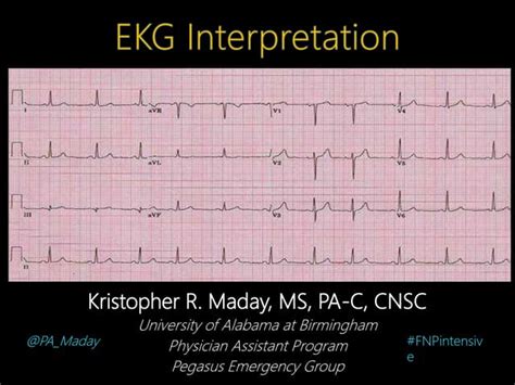 Introduction To Ekg Interpretation Ppt