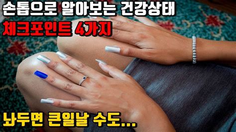 손톱이 알려주는 건강신호~ 건강정보의 지표 손톱으로 건강체크하시고 건강상태 미리미리 알아보세요손톱세로줄 Youtube