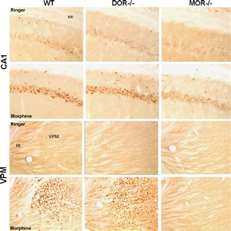 Photomicrographs Of Morphine Icsa Induced Fos Protein Expression Within