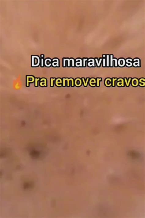 Como Tirar Cravos Do Nariz E Espinhas Em 2024 Tira Cravos Do Nariz