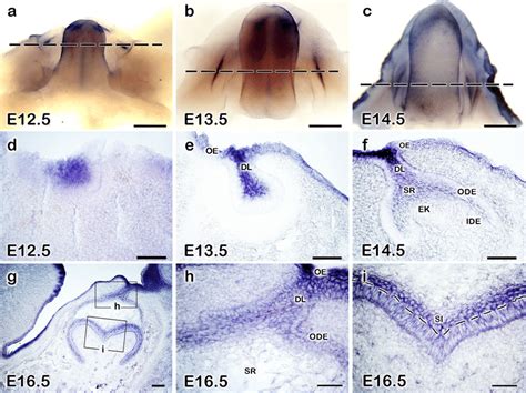 Ac Whole Mount In Situ Hybridization With Digoxigenin Labeled Perp