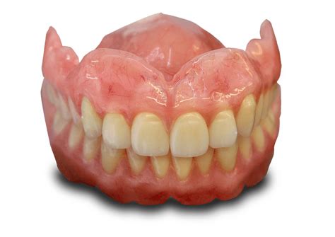 Solutions to Common Denture Problems at Lane Ends Dental Practice