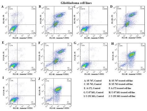 Evaluation Of The Apoptosis Inducing Effect Of Vpa On Glioblastoma