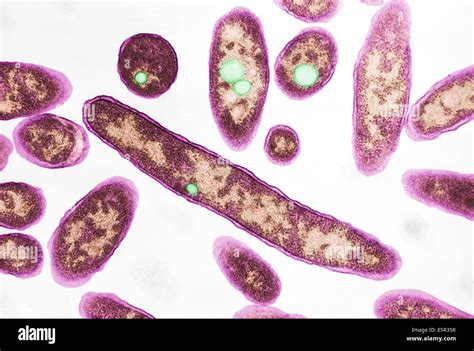 Transmission Electron Micrograph Tem Of Legionella Pneumophila The Bacteria Known To Cause