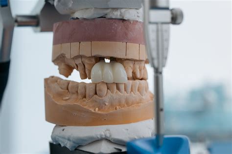 How Often Should I Replace My Dentures