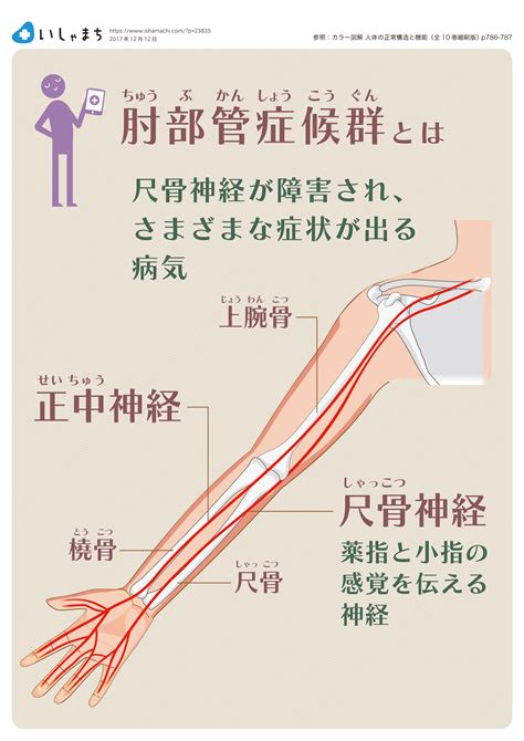 小指のしびれがサイン！肘部管症候群の症状と原因は？ いしゃまち