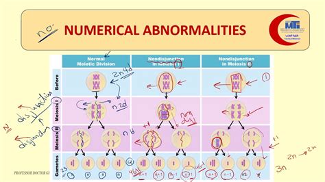 Med Level Bg Lecture Chromosomal Abnormalities Youtube