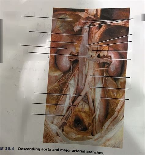 Descending Aorta And Major Arterial Branches Diagram Quizlet