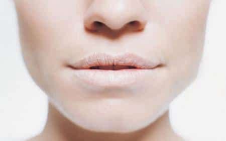 Labios Agrietados Causas C Mo Prevenir Y Remedios Emujer