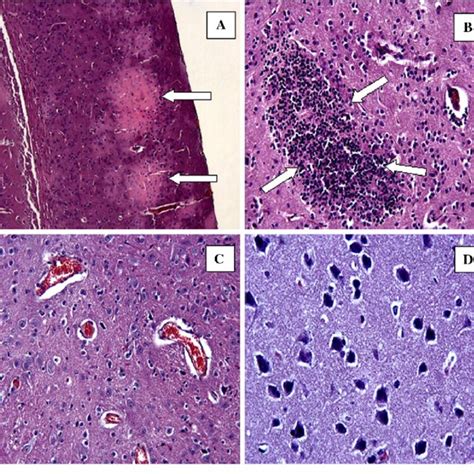 Decreases In Mononuclear Cell Infiltration Arrows Hande 920 And