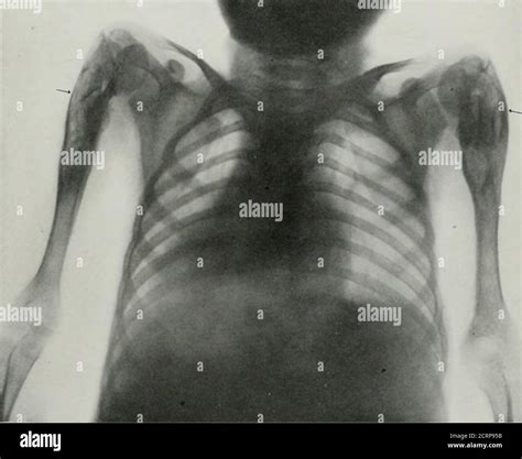 Living Anatomy And Pathology The Diagnosis Of Diseases In Early Life